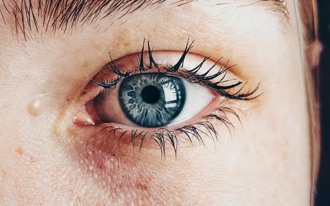 Online Skin Consultation